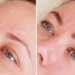 Brow lamination before after